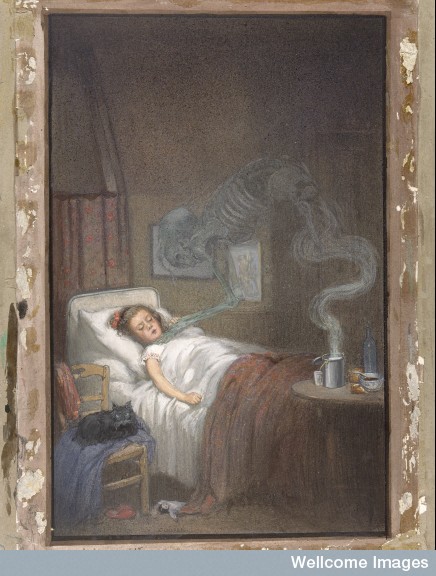 An artist's depiction of a child with diptheria
